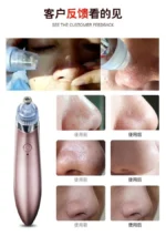 Cleaner XN-8030 Blackhead Remover Vacuum Pore Cleaner – Adjustable Suction Acne & Skin Care Device - Image 2